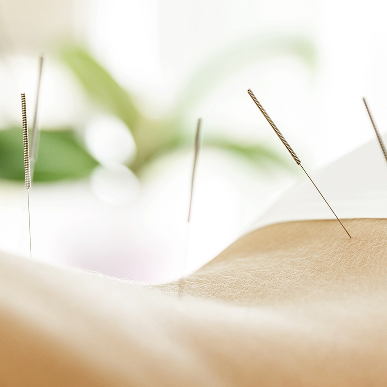 Acupuncture service fee